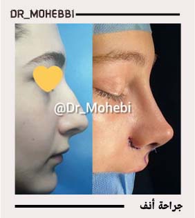 الدکتور علیرضا محبی - dr-mohebbi-ar.com