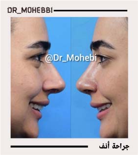 الدکتور علیرضا محبی - dr-mohebbi-ar.com